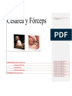 Cesarea y Forceps
