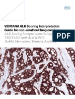 ALK D5F3 NSCLC Interpretation Guide EN