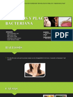 Halitosis y Placa Bacteriana