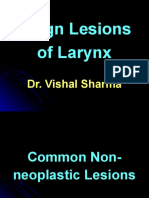 14 Benign Lesions of Larynx