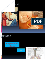 Pulmonary Tromboembolic Disease