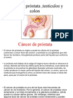 Cáncer de Próstata, Testículos y Colon