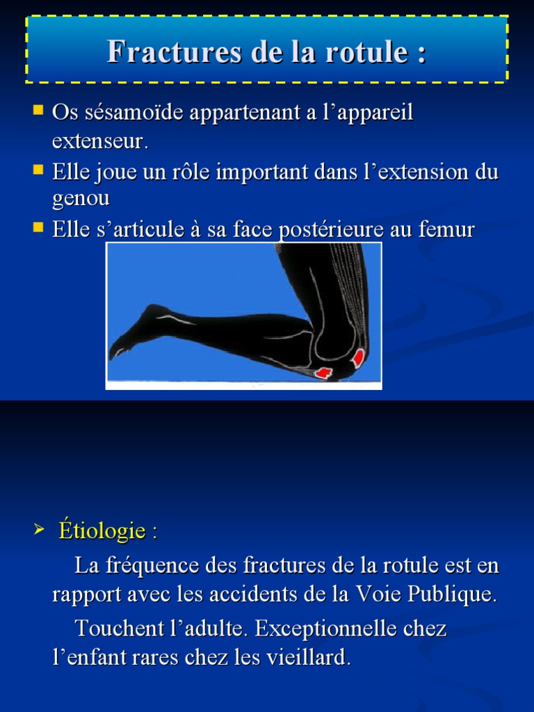 3 Fracture de La Rotule PDF