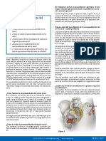 Sacral Neuromodulation Spanish