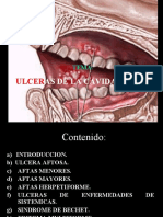 Ulceras de La Cavidad Oral 2017
