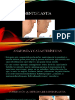 Mentoplastia