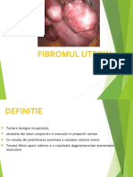 Fibromul Uterin