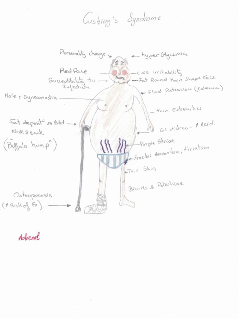 Cushing Syndrome and Addison S Disease PDF