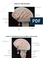 Atlas Digital de Neuro - II