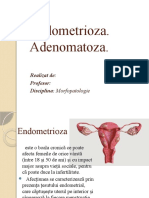 Endometrioza