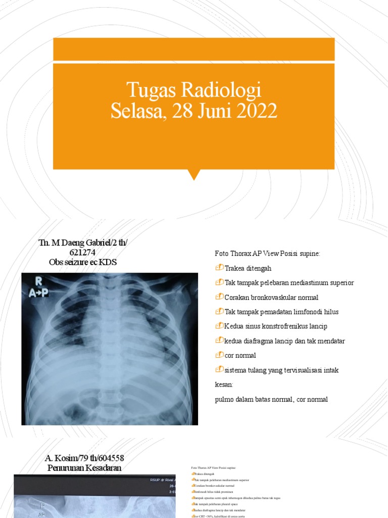 Sistem Tulang Intak dalam Radiologi | PDF