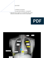 Práctica 9 - Imágenes RX