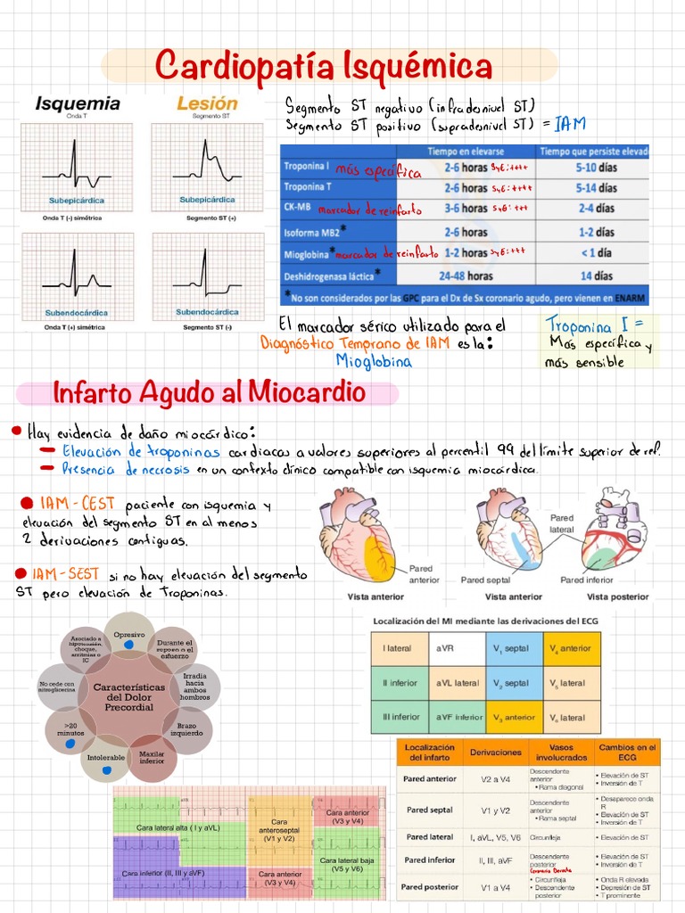 Diagnóstico y Tratamiento de IAM | PDF | Infarto de miocardio ...