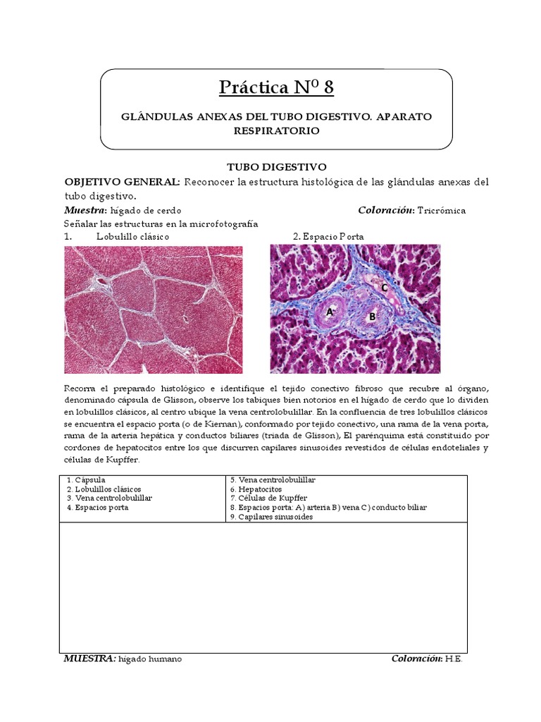 Granulomas infecciosos del hígado, image size:768x1024