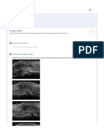 Musculoskeletal Joints and Tendons - 6.8 Foot - Case 6.8.6 Foreign Bodies in The Foot 4 - Ultrasound Cases