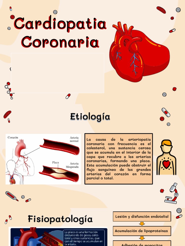 Fisiopatología y Diagnóstico de Cardiopatía Coronaria | PDF | Infarto ...