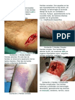 Tipos de heridas y clasificación