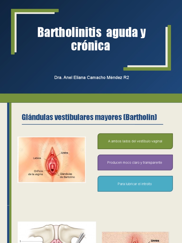 Bartholinitis: Diagnóstico y Tratamiento | PDF | Penicilina | Causas de ...