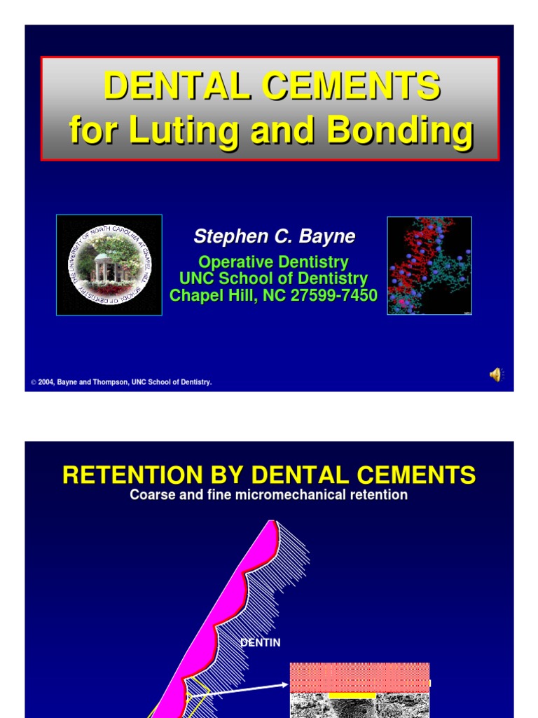 Dental Cements PPT