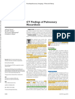 CT Findings of Pulmonary Nocardiosis