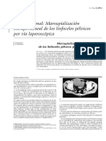 Marsupializacion Intraperitoneal de Los Linfoceles Pelvicos