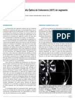 Tomografía Óptica de Coherencia (OCT) de Segmento Anterior