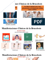 Manifestaciones y Diagnóstico de la Brucelosis