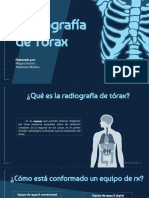 Presentación Radiografía de Torax Final