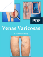 Trabajo Final de Fisiopatologia I-Venas Varicosas-Flebectomia