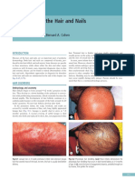 Disorders of the Hair and Nails: Diagnostic Clues from Pediatric Dermatology