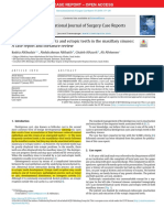 Bilateral Dentigerous Cysts and Ectopic Teeth in The Maxillary Sinuses