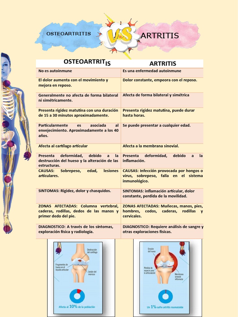 Artrosis Vs Artritis | PDF