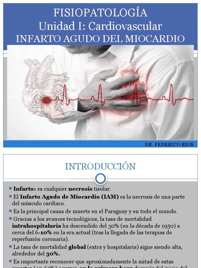 1.infarto Agudo Del Miocardio | PDF | Infarto de miocardio ...