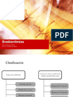 Bradiarritmias