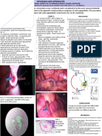 Worm Appendicitis