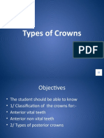 Types of Dental Crowns for Anterior and Posterior Teeth