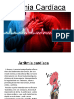 Arritmia Cardíaca