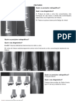 Fraturas: Posições radiográficas e diagnósticos