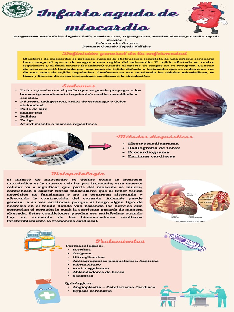 Infarto Agudo de Miocardio: Diagnóstico y Tratamiento | PDF | Infarto ...