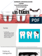 Caries