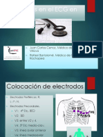 Anomalías ECG AP