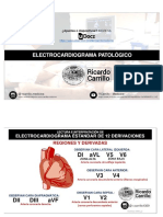 Eletrocardiograma Patologico