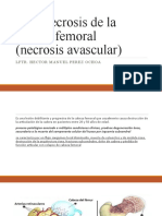 10 Osteonecrosis de La Cabeza Femoral (Necrosis Avascular)