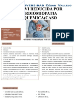 Pericarditis Cronica