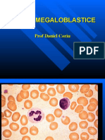 ANemia megaloooblostik