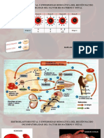 Eritroblastosis Fetal o Enfermedad Hemolítica Del Recién Nacido