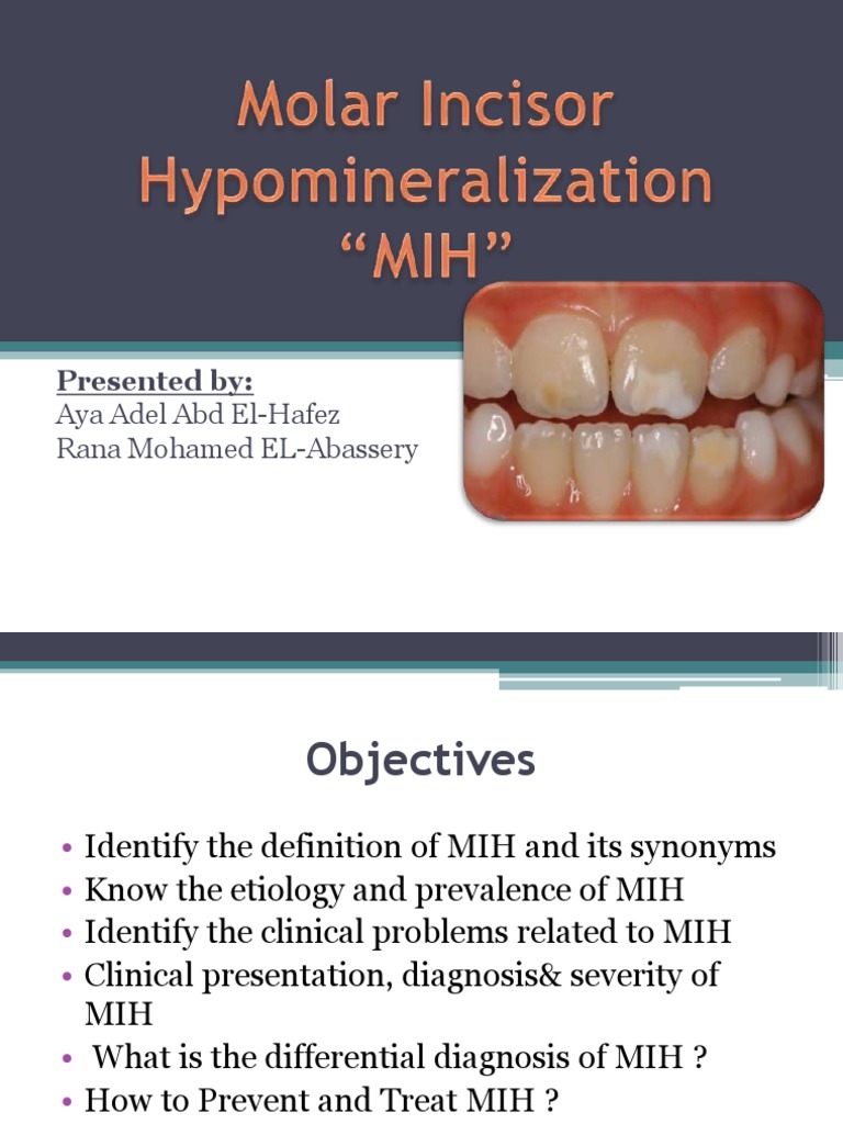 Molar Incisor Hypomineralization Overview | PDF | Tooth Enamel | Tooth