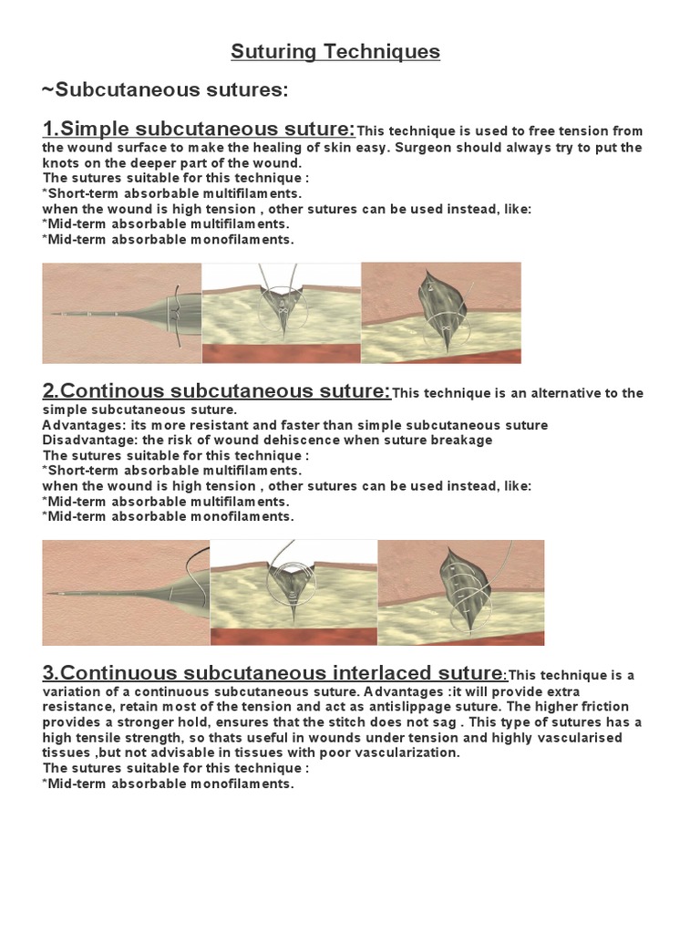 Suturing Techniques Download Free Pdf Surgical Suture Clinical