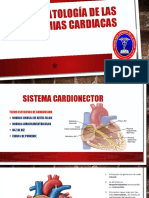 Fisiopatologia Arritmias Cardiacas
