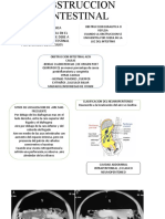 Obstruccion Intestinal